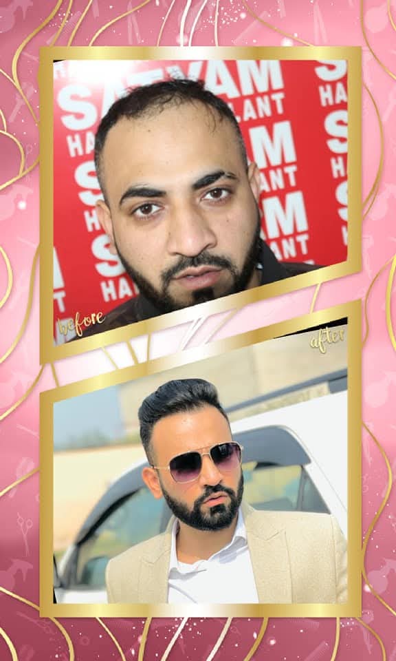 A dramatic before and after hair transplant result from Satyam Hair Transplant Centre. The 'before' shows frontal hair loss and a receding hairline, and the 'after' shows a complete, dense, and stylish hair restoration with a modern, confident look.