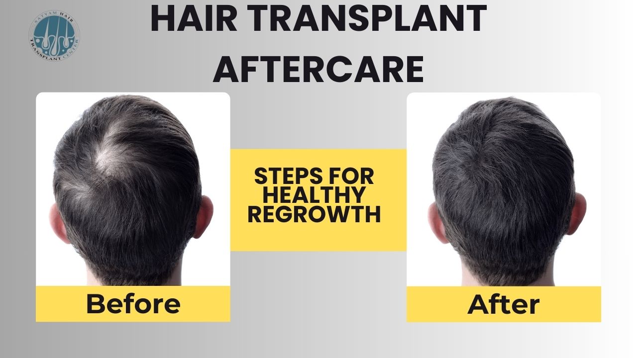 Before and after comparison of a male hair transplant patient showing vertex balding versus full regrowth. The graphic includes the text 'Hair Transplant Aftercare: Steps for Healthy Regrowth' and the Satyam Hair Transplant Center logo