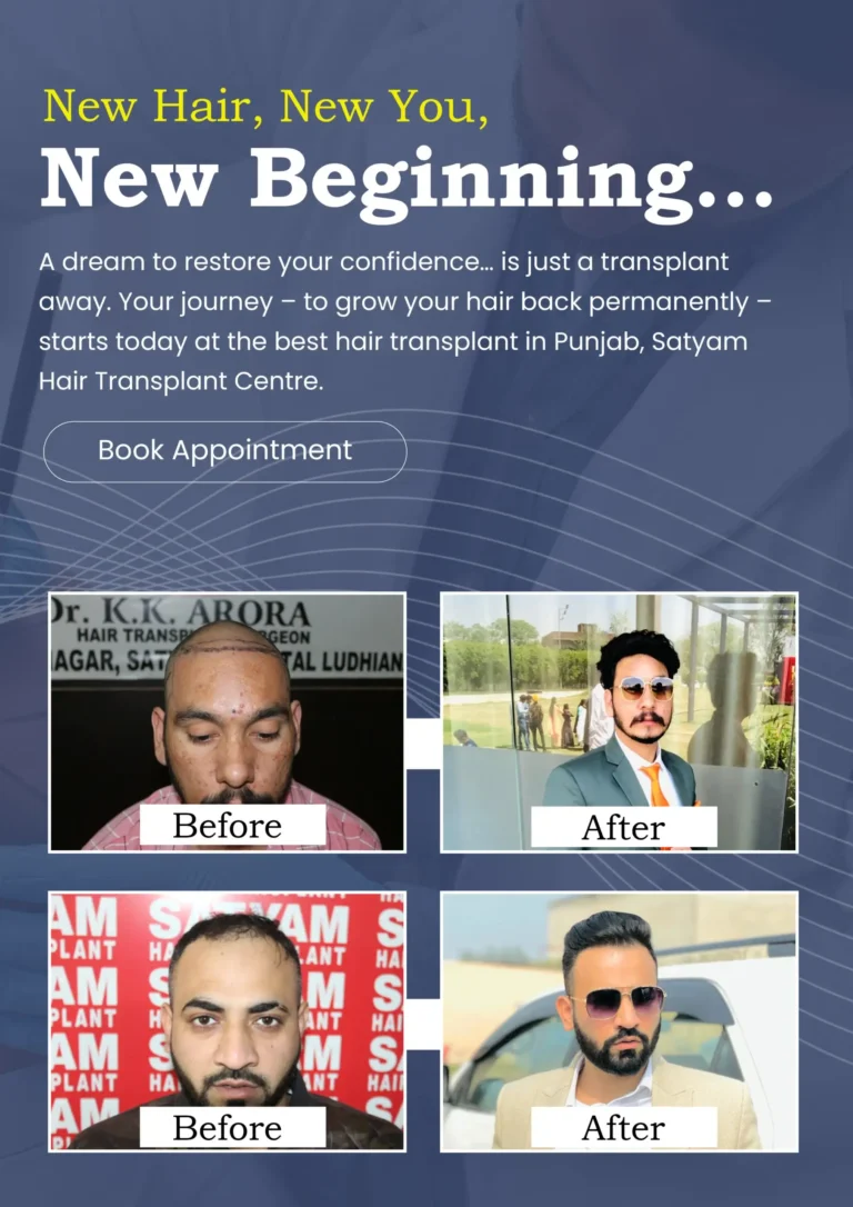 hair transplant real results punjab (1)