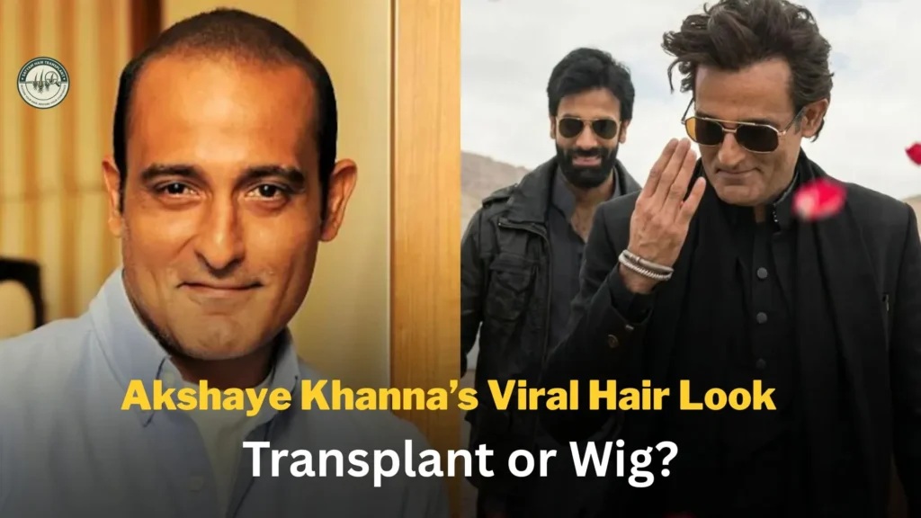 Akshaye Khanna before and after hair transformation showing bald look and fuller hair, sparking hair transplant or wig speculation